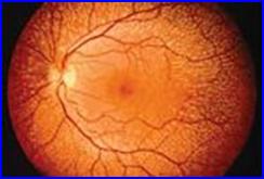 Retina azonosító beléptető rendszer